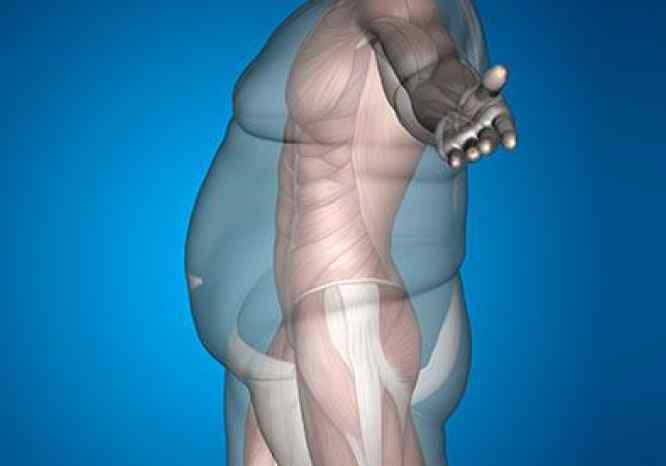 clasificacion de la obesidad